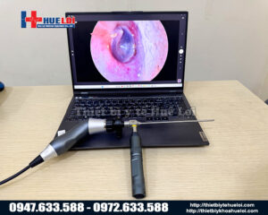 Máy nội soi tai mũi họng mini-nguồn sáng di động