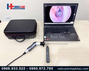 Máy nội soi tai mũi họng mini-nguồn sáng di động