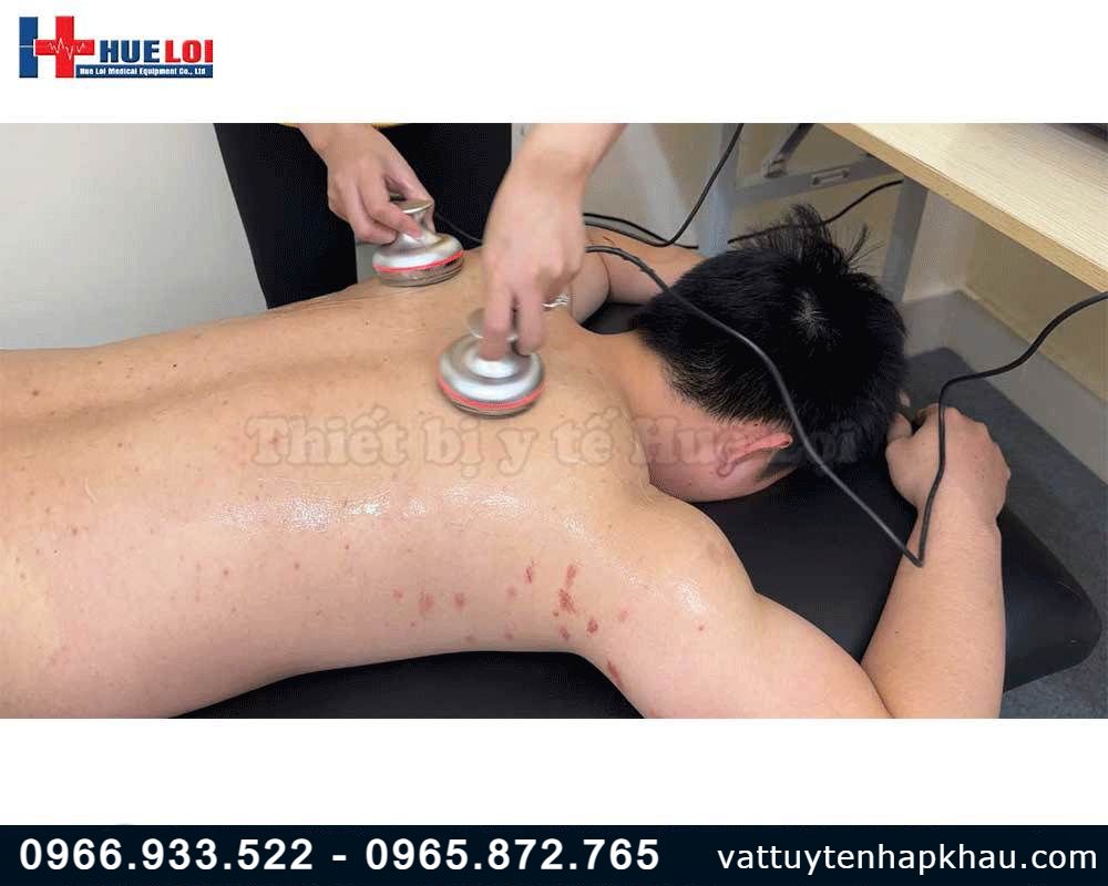 Máy châm cứu không kim kết hợp giác hút