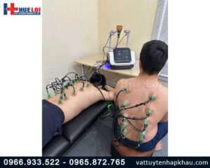 Máy châm cứu không kim kết hợp giác hút