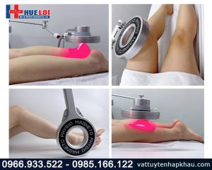 Máy từ trường siêu dân kết hợp laser lạnh cao cấp